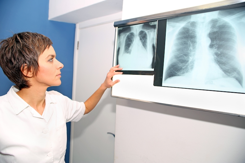 Doctor Examining Lung X-Rays